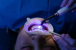 Lee más sobre el artículo Blanqueamiento dental: Mitos y verdades sobre cómo lograr una sonrisa brillante