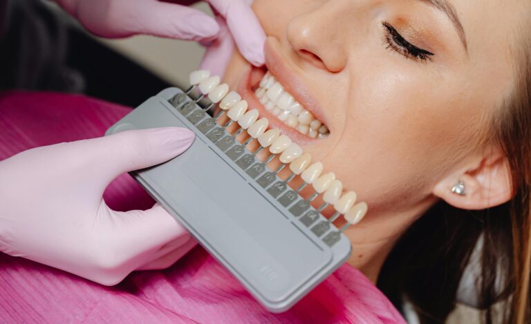 Lee más sobre el artículo ¿Qué son las carillas dentales y cómo pueden transformar tu sonrisa?