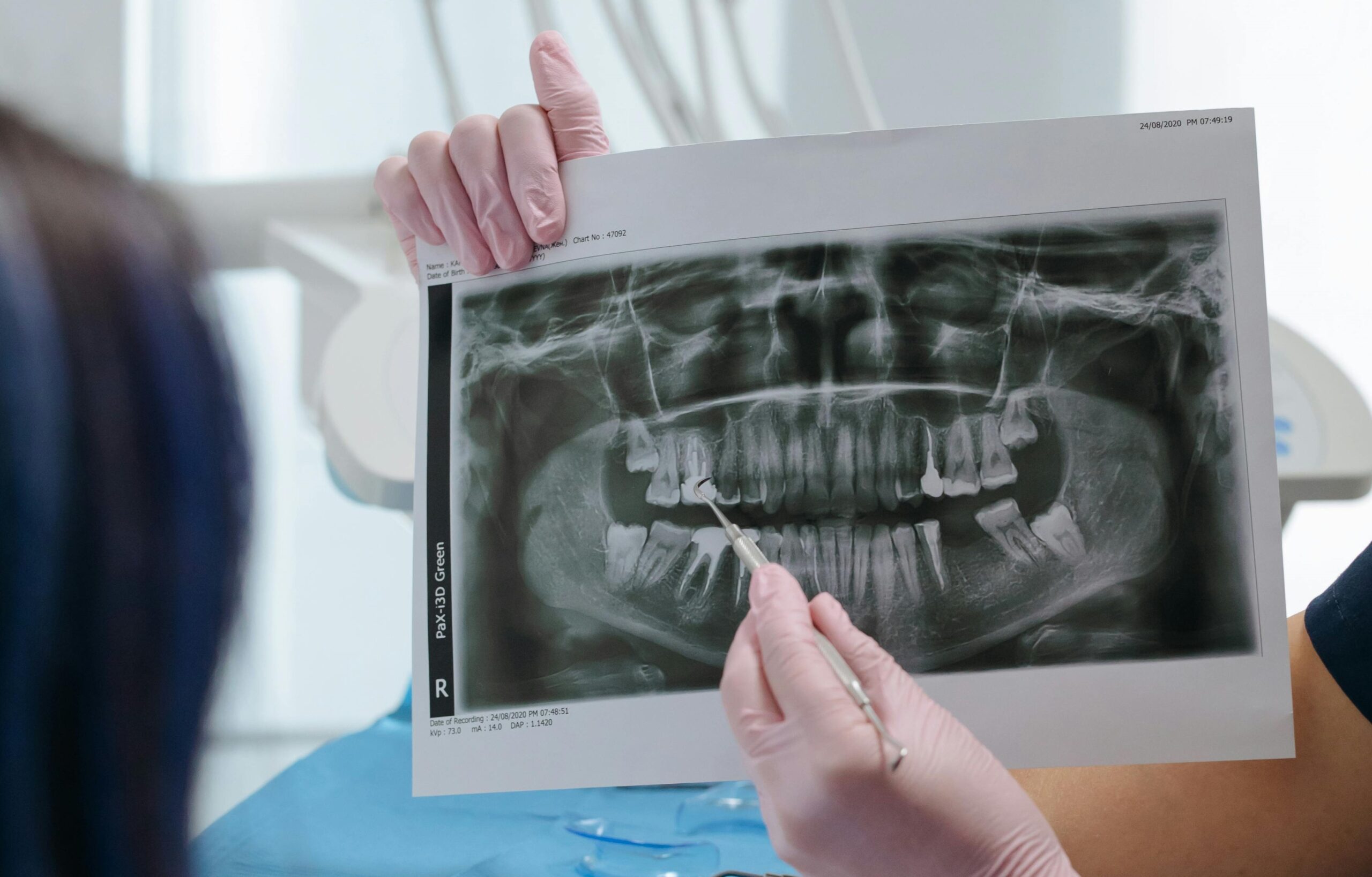 En este momento estás viendo ¿Qué es una ortopantografía y para qué sirve?