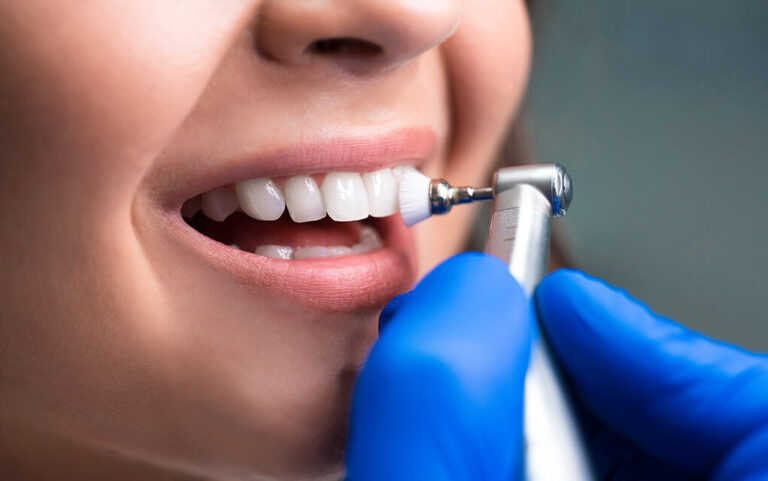 🦷 Guía completa de la limpieza dental profesional: paso a paso